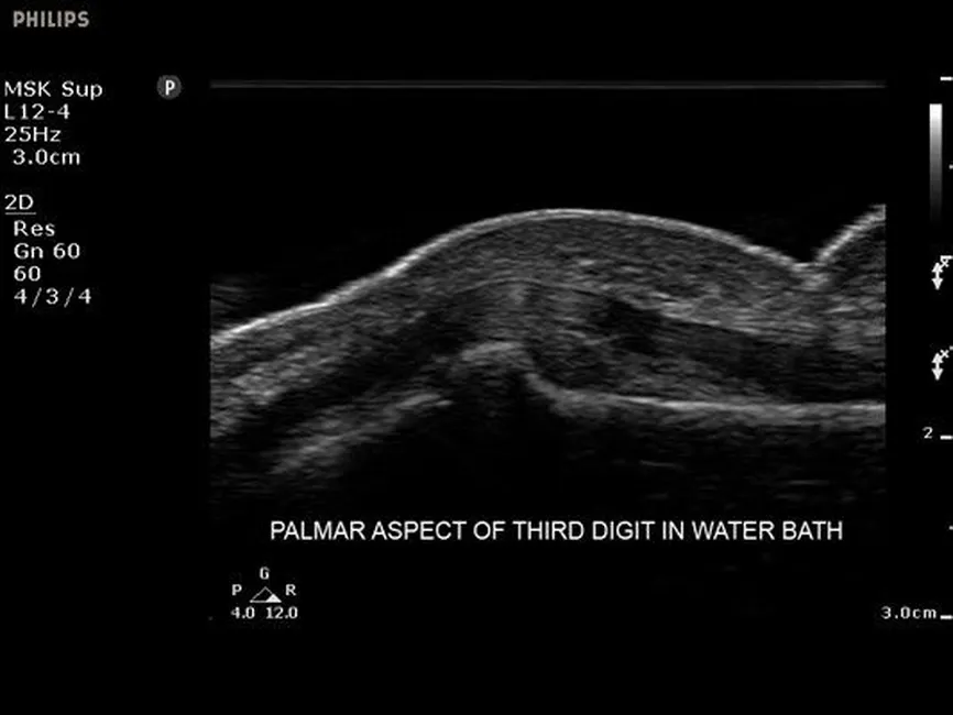 Клинические изображения - УЗИ аппарат Philips Sparq